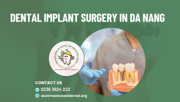 Dental Implant Surgery in Da Nang: Your Ultimate Guide
