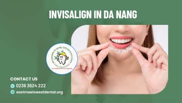 Everything you’ll need to know about Invisalign in Da Nang Invisalign-in-Da-Nang